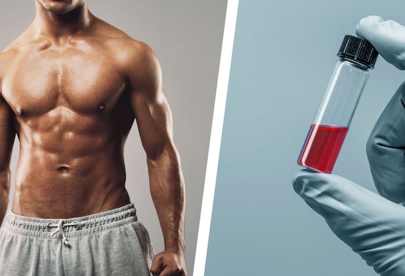 What to Expect During Your First Testosterone Injection Appointment